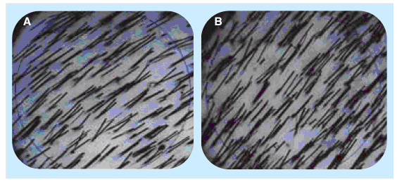 CYPサプリ前と使用後の比較（アップ）