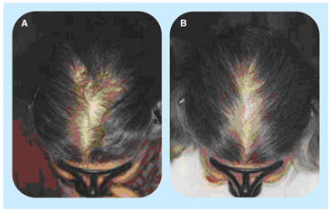 CYPサプリ前と使用後の比較（全体像）