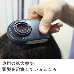 2.診察 専用の拡大鏡で頭髪を診察しているところ